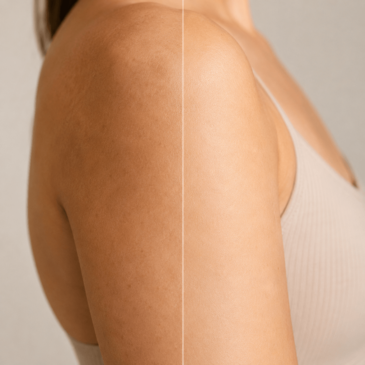 Uneven Skin Tone (Body)